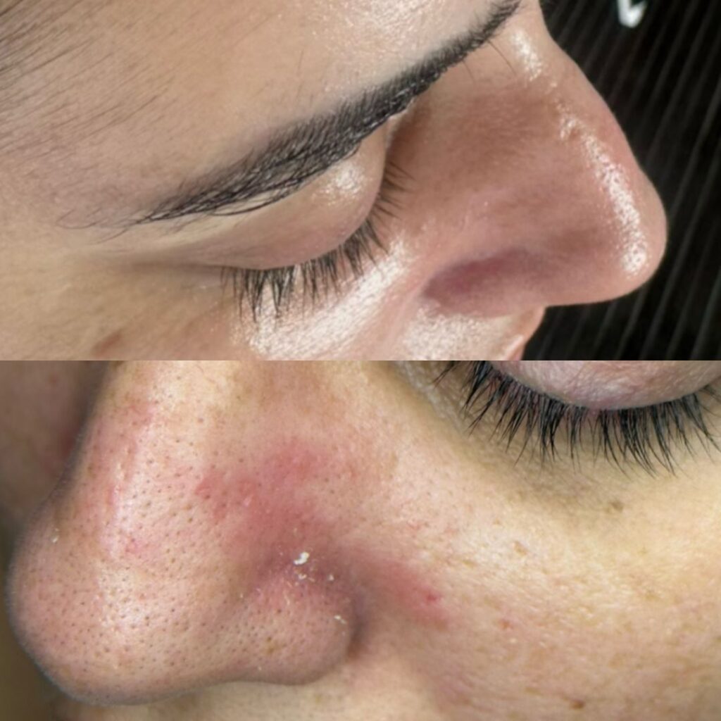 מראה עור טבעי ובריא לאחר טיפול קוסמטי