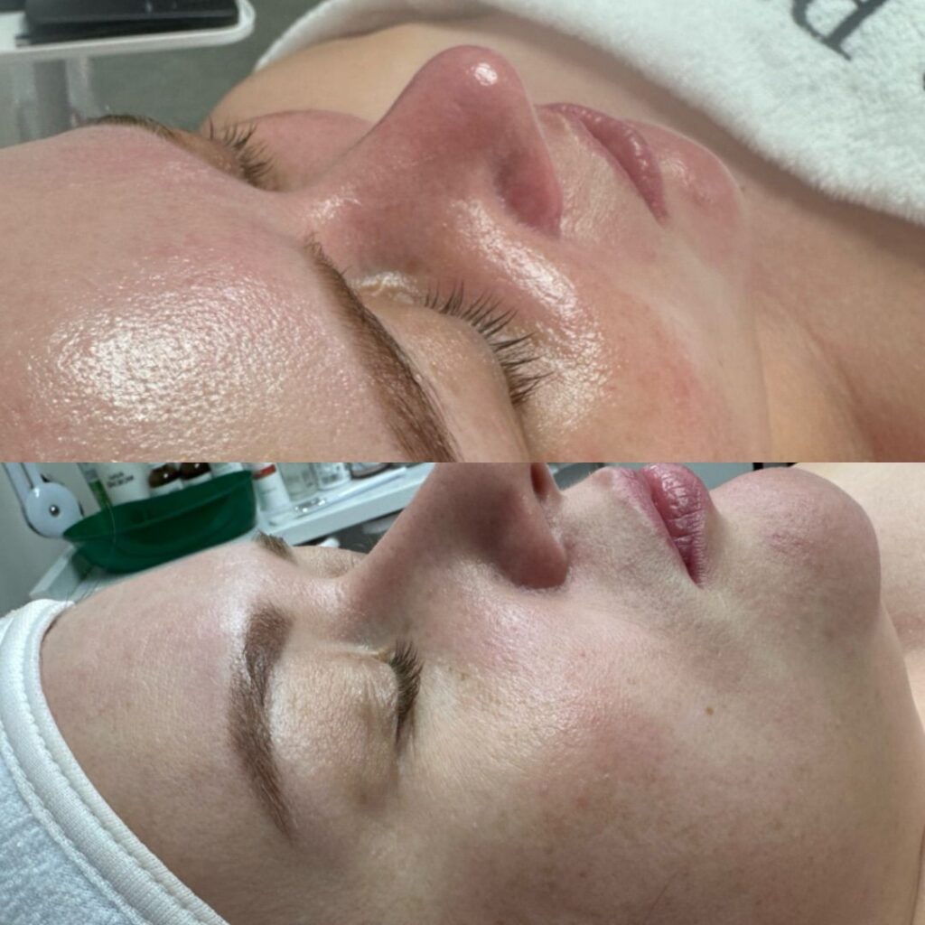 עיצוב גבות מקצועי בהתאמה למבנה הפנים